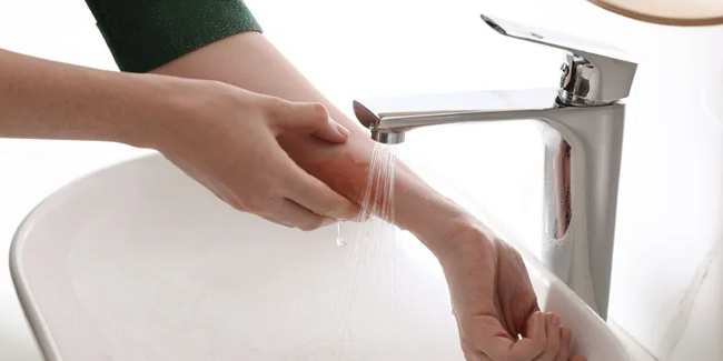 গরম পানিতে হাত পুড়ে গেলে করণীয়